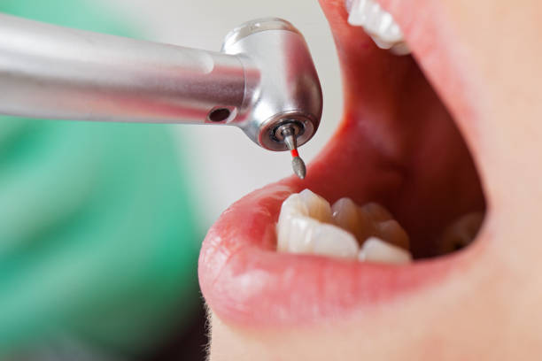 Best Emergency Treatment for Oral Infections in Thunder Mountain, NM